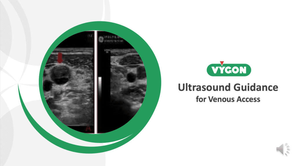 Ultrasound guided presentations image
