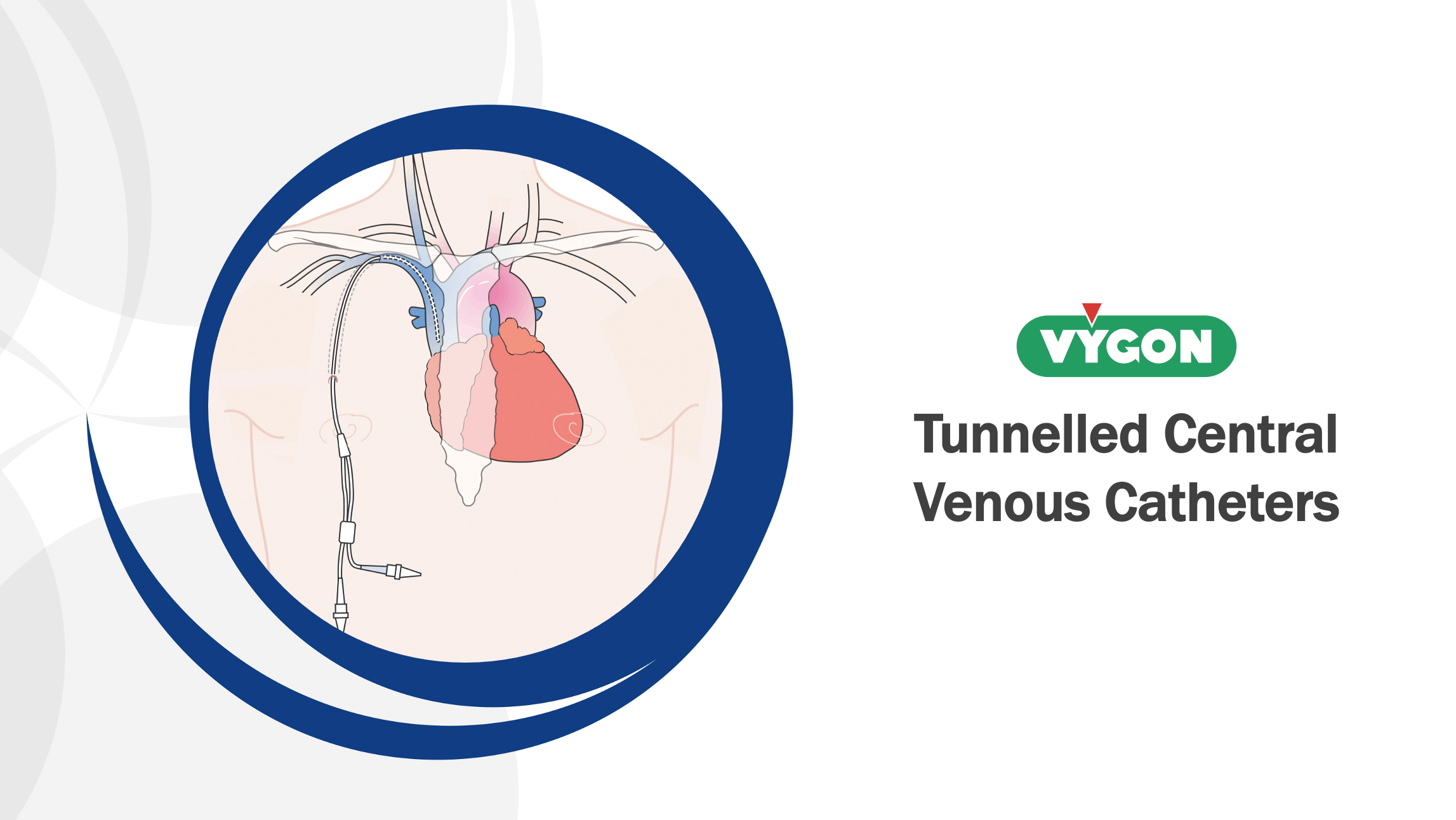 Vygon Tunnelled Central Venous Catheters
