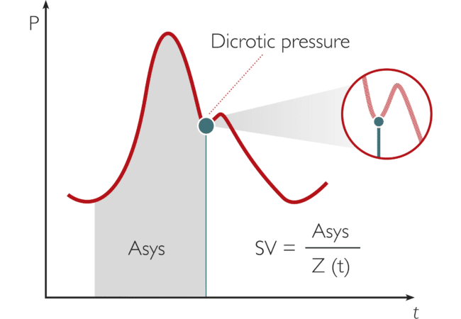 PRAM Pressure Recording Analytical Method Graph