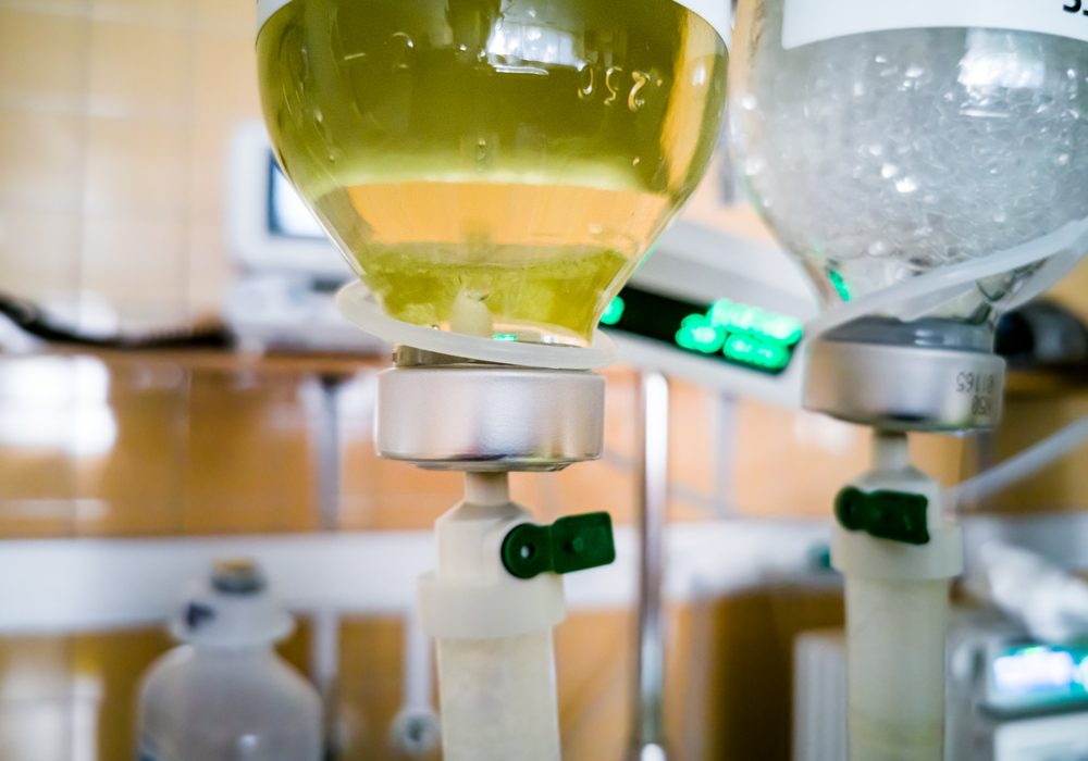 Infusion,Drips,With,Bottles,Of,Yellow,Albumin,Fluid.